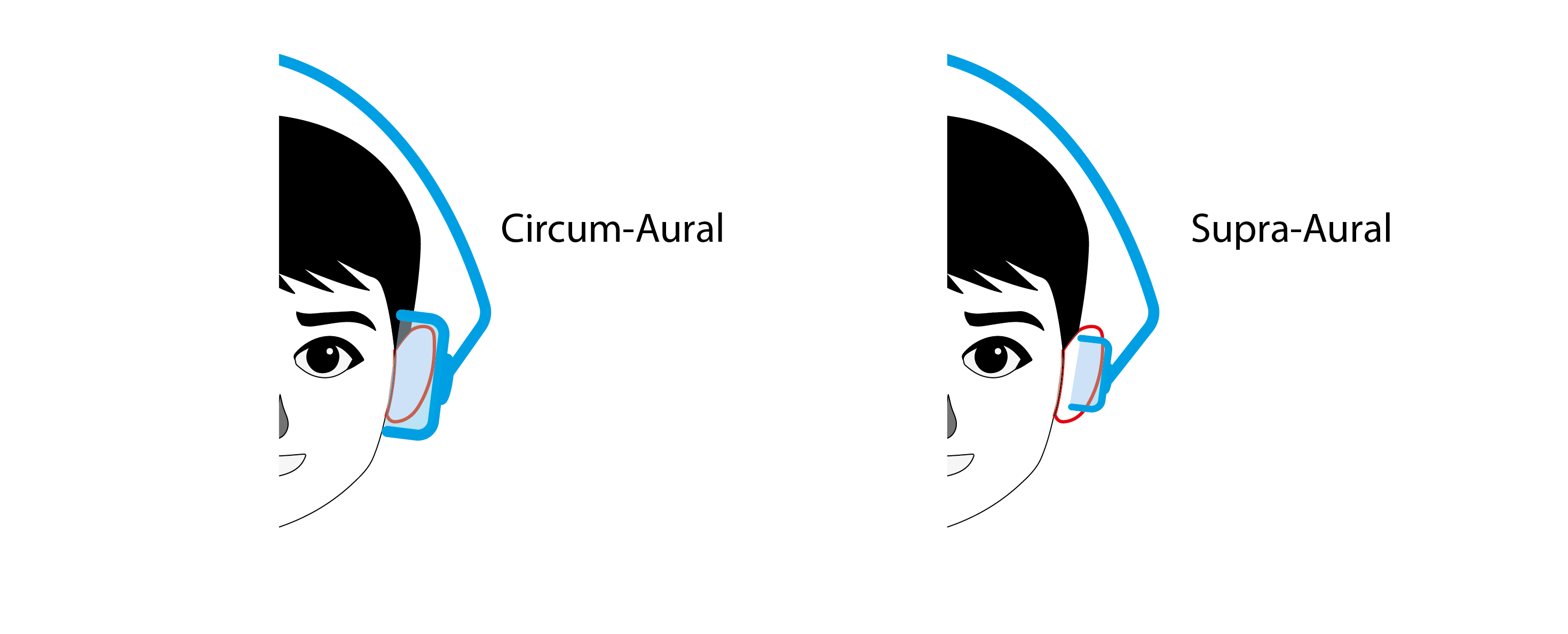 Qu’est-ce que le circum-aural ou supra-aural ? 